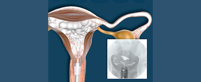 ڱóȰ X-RAY 